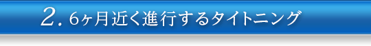 2.６ヶ月近く進行するタイトニング